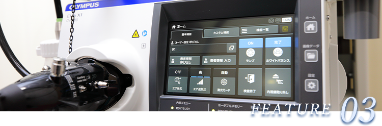 最新の内視鏡システム「EVIS X1」で見逃しのない検査