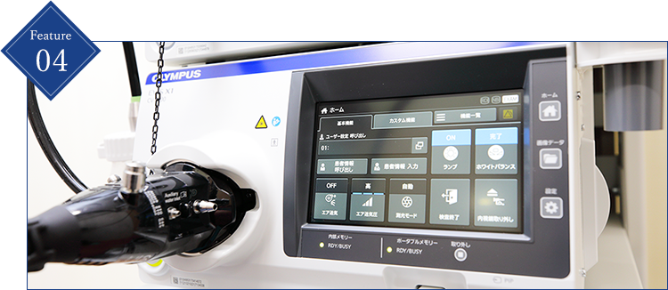 最新の内視鏡システム「EVIS X1」で見逃しのない検査