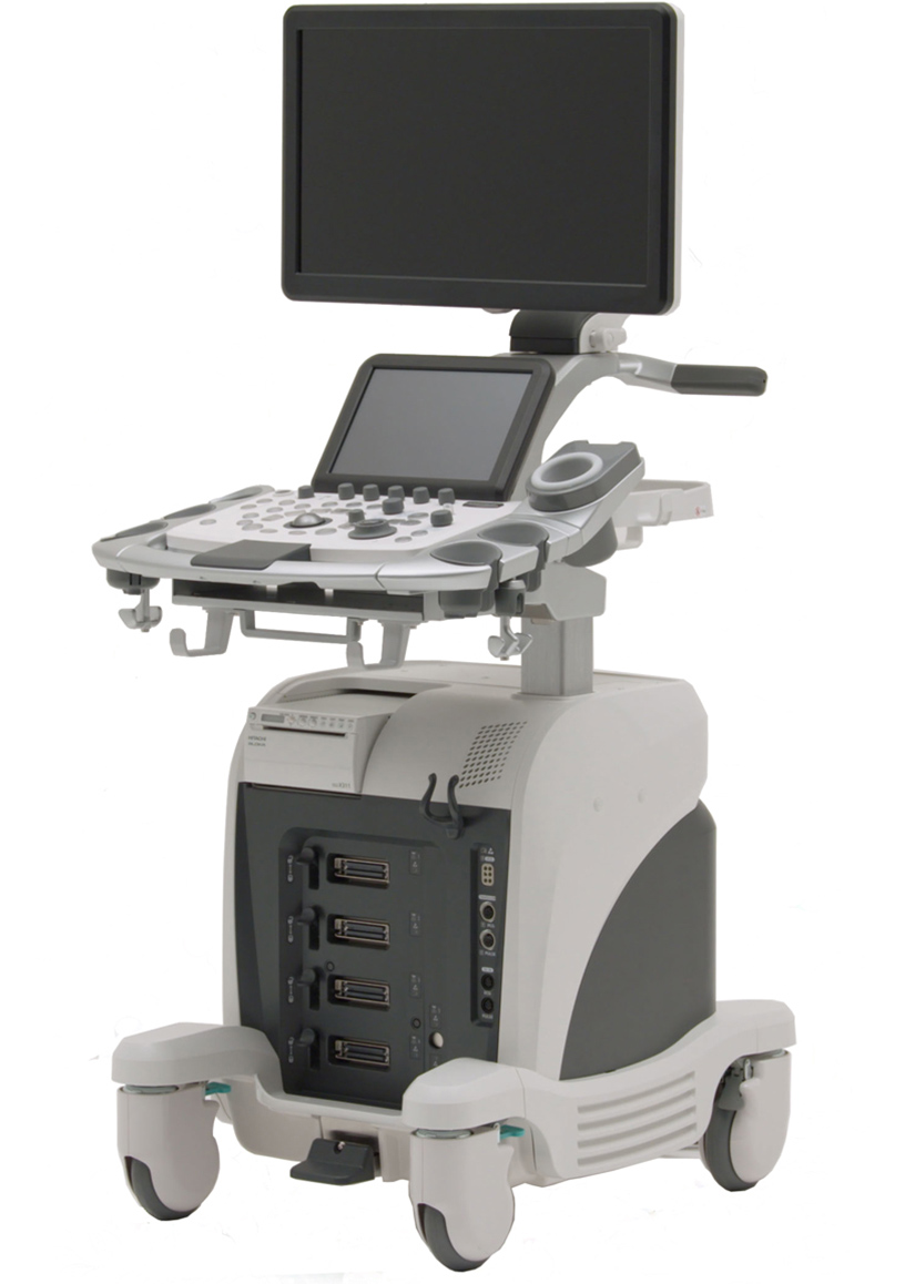 野々市中央院の超音波検査（エコー）機器